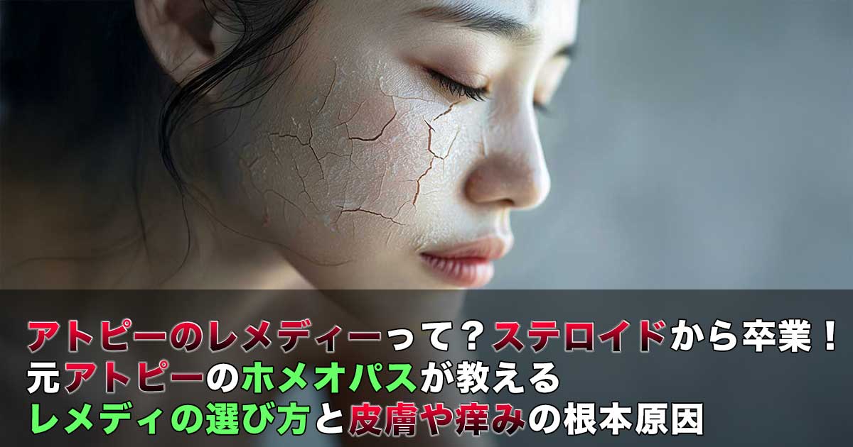 アトピーで肌がひび割れている女性の横顔